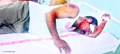 వేర్వ