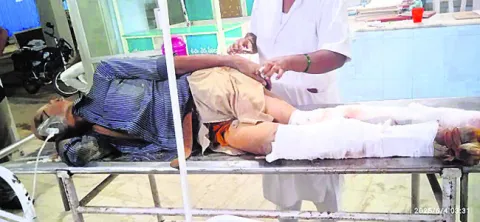 బస్సు చక్రాలు ఎక్కడంతో అటెండర్‌కు గాయాలు