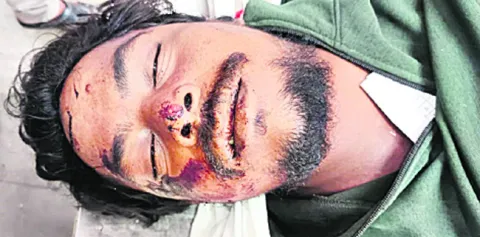 రోడ్డు ప్రమాదంలో యువకుడు దుర్మరణం 