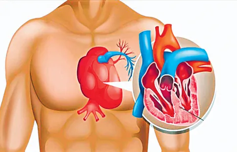 Men are twice as likely to die of broken heart syndrome than women