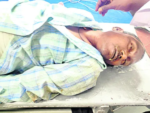 అనుమా