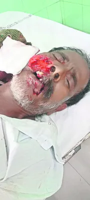 పిచ్చ
