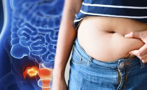 Yoga Best remedy for Stomach bloating check here
