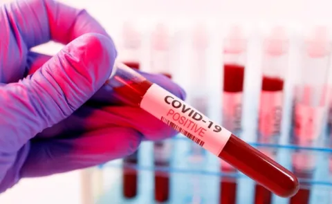 Covid 19 India touched 6491 Cases  no deaths in last 24 hours