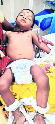 బాలుడిని రక్షించిన వైద్యులు