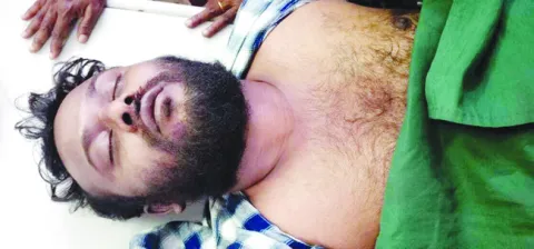 తేనె కోసమెళ్లి..  
