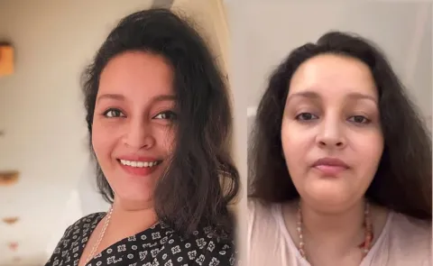 Actress Renu Desai Shares Photo After Surgery