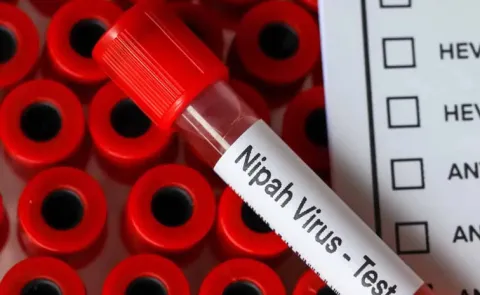 Nipah Virus Second Suspected Death Reported in Kerala14