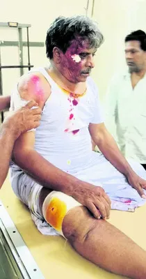 ఆటో బోల్తా – ఒకరి మృతి 