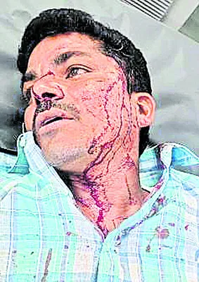 టీడీప