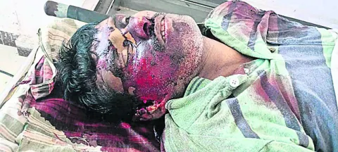 లారీ ఢీకొని తాపీ కార్మికుడి మృతి 