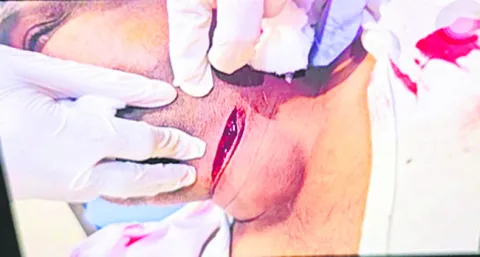 కాంగ్రెస్‌ నాయకుడిపై హత్యాయత్నం 
