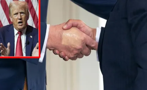 US president has been diagnosed with chronic venous insufficiency