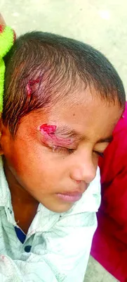 ప్రాణాలు పోతున్నా పట్టింపేది..
