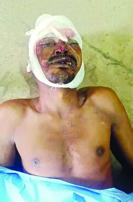 డివైడర్‌ను ఢీకొని వ్యక్తి మృతి 