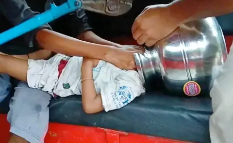 Child head gets stuck inside steel