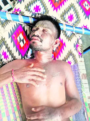 భర్తపై వేడినీళ్లు పోసిన భార్య