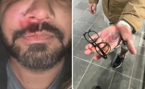 Indian Origin Unprovoked Racist Attack by Teenagers12