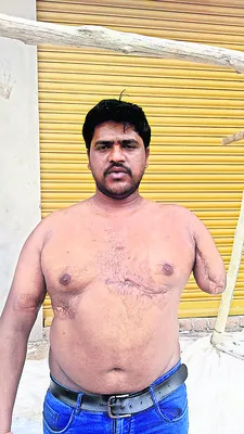 అంగవైకల్యమైనా నయా పైసా ఇవ్వలే..
