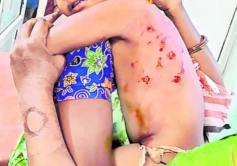 పెరిగిన వీధికుక్కల బెడద... 
