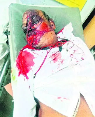 బైక్‌ అదుపు తప్పి వ్యక్తి మృతి