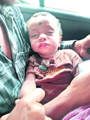 రెండేళ్ల బాలుడికి పాముకాటు