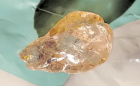 52-carat diamond was found in NTR district was buzz in WhatsApp groups