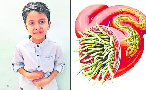 నులిమేద్దాం 