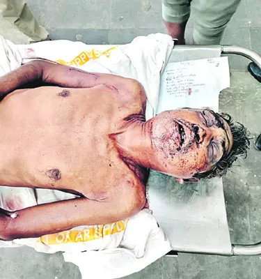 తండ్రిపై కుమారుడు దాడి 