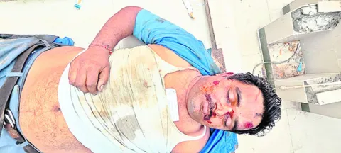 రోడ్డు ప్రమాదంలో వ్యక్తి దుర్మరణం