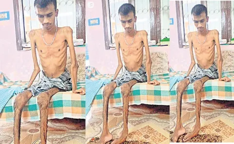 Kanipakam: Physically-challenged man who lost Pention