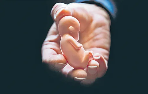 Abortions in the state have increased by 917 percent in five years