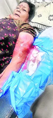 ఇంజక్షన్‌ సక్రమంగా చేయక ఇన్‌ఫెక్షన్‌ 