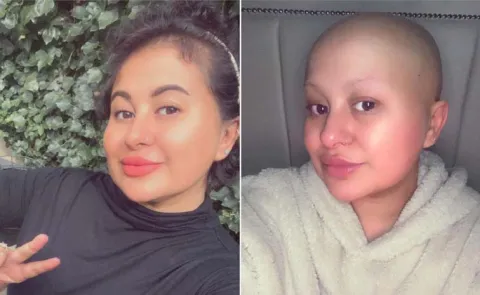 Pregnant Woman Diagnosed with non-Hodgkin lymphoma or blood cancer