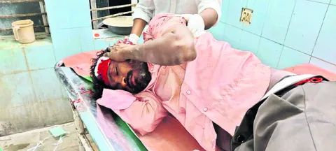రోడ్డు ప్రమాదంలో ఇద్దరికి తీవ్ర గాయాలు 