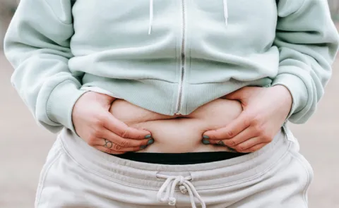 PCOS Belly Losing Difficult check causes and amazing tips