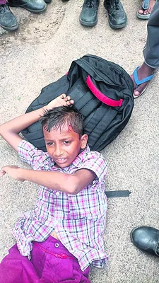 మోడల్‌ స్కూల్‌ విద్యార్థులకు గాయాలు 
