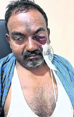 నేతన్న కంట్లో దిగిన జోటా