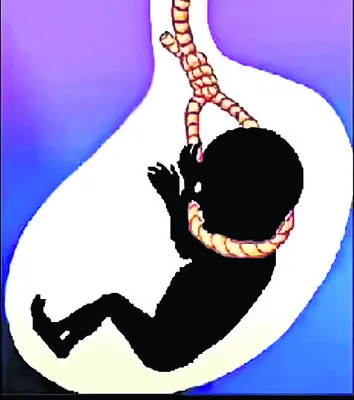 లోకం చూడని బిడ్డలు
