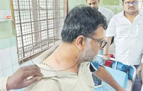 Chilamathur YSRCP MPP attacked by TDP goons