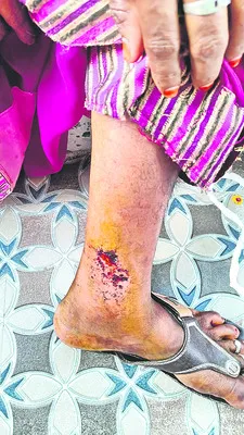 పిచ్చికుక్క స్వైర విహారం