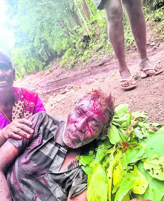 ఎలుగుబంటి దాడిలో కూలీకి గాయాలు