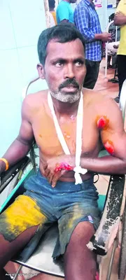 బైక్‌ అదుపుతప్పి యువకుడికి తీవ్ర గాయాలు