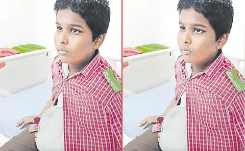 Andhra Pradesh: Teacher breaks student arm over misbehavior