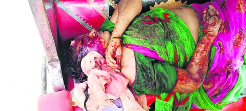 రోడ్డ