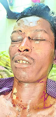 రైలు నుంచి జారిపడి వ్యక్తి మృతి  