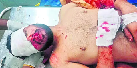 ఆటో ఢీకొని..