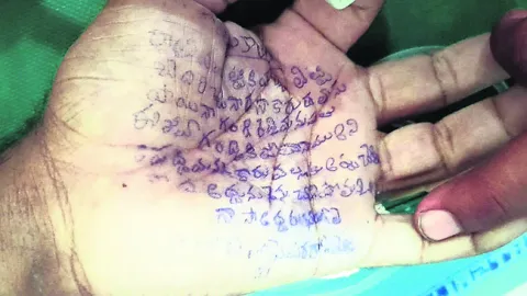 విషగు