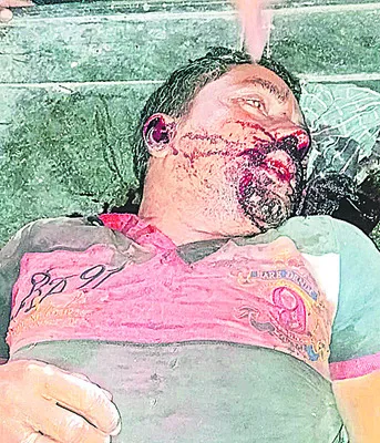 పొక్లెయిన్‌ తగిలి వ్యక్తి దుర్మరణం