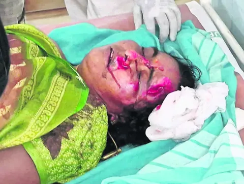 వేర్వ